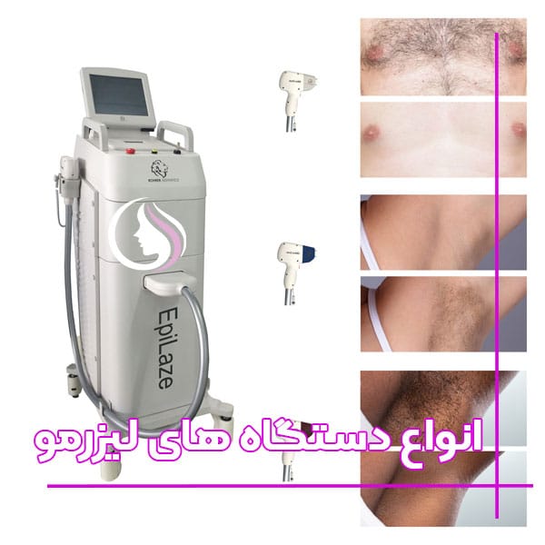 انواع-دستکاه-های-لیزر-مو-های-زائد