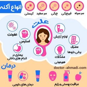 انواع آکنه و راه درمان
