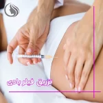 فیلر بادی چیست و چگونه اندام ما را تغییر می‌دهد؟