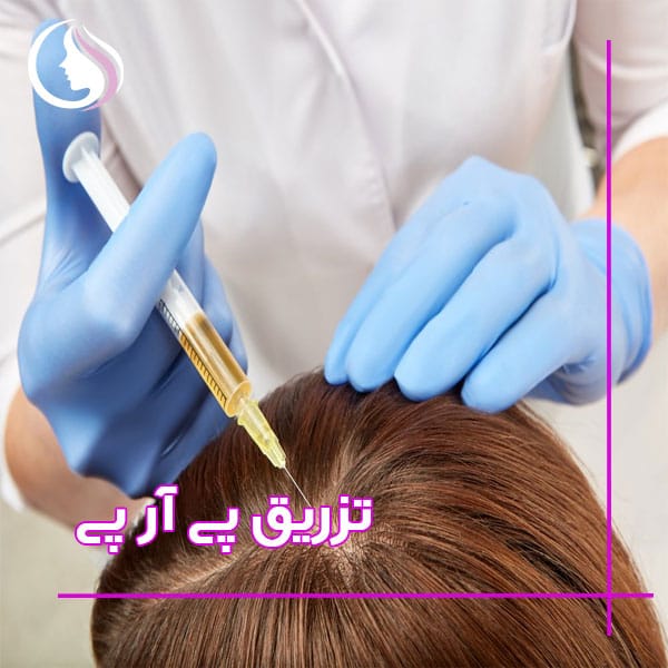 چه کسانی از پی آر پی نتیجه گرفتن