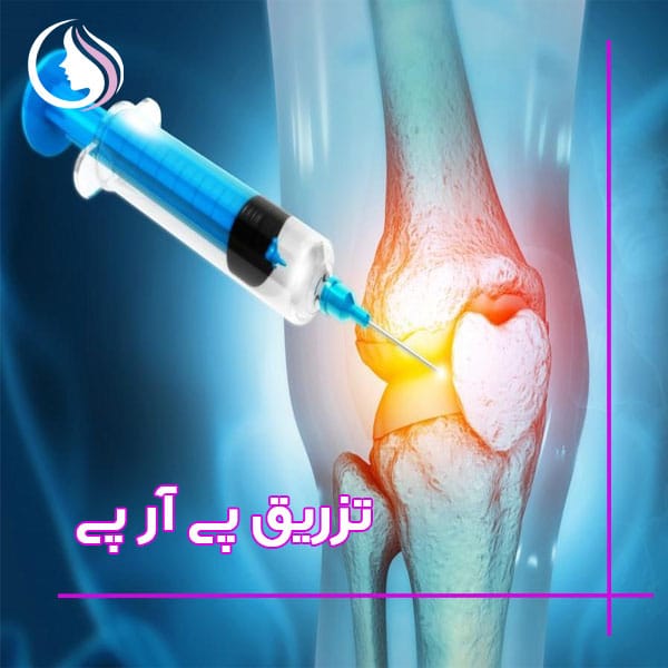 کیا از پی آر پی نتیجه گرفتن