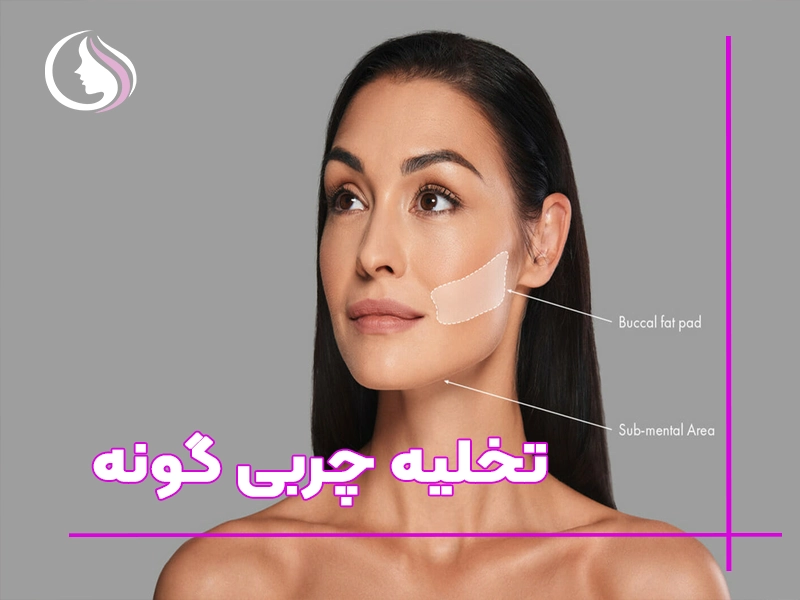 تخلیه چربی گونه