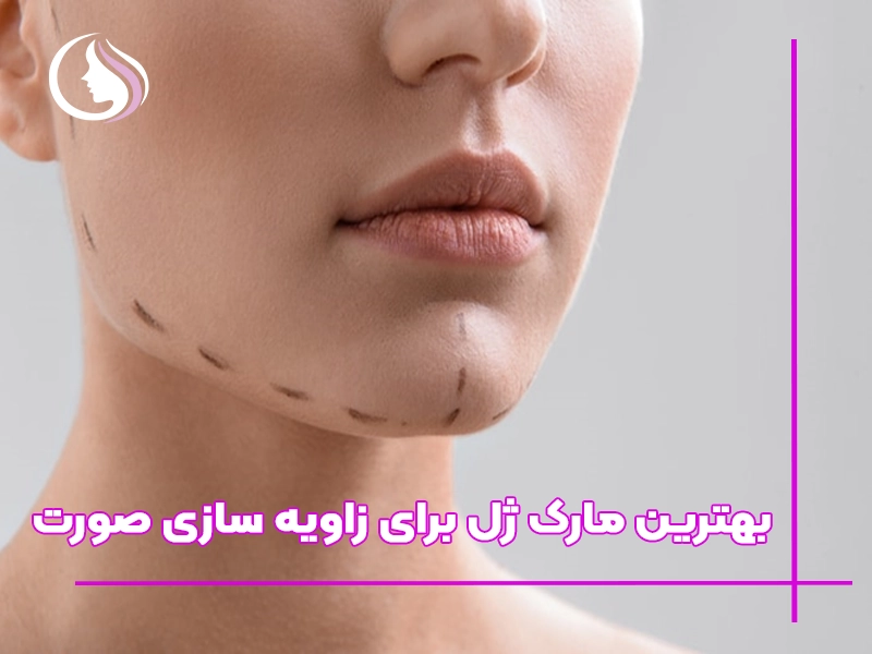 برند ژل برای زاویه ‌سازی صورت