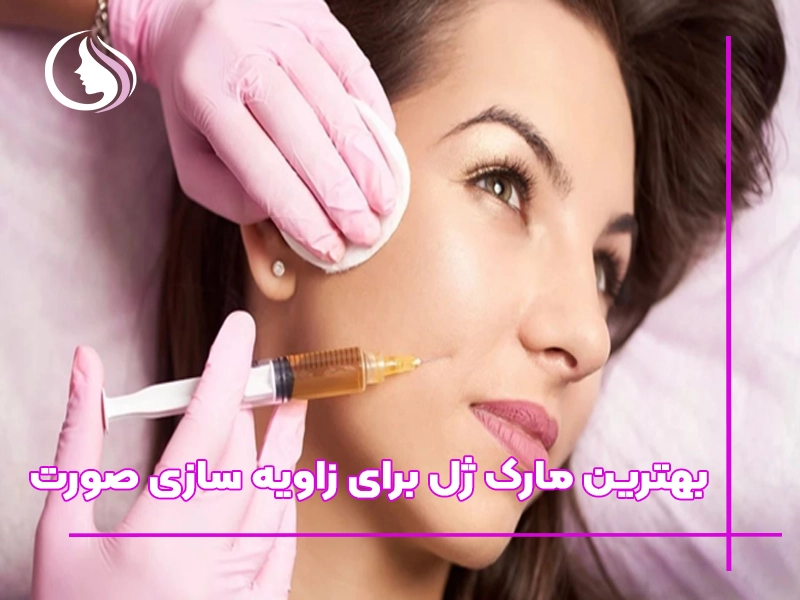 بهترین مارک ژل برای زاویه ‌سازی صورت