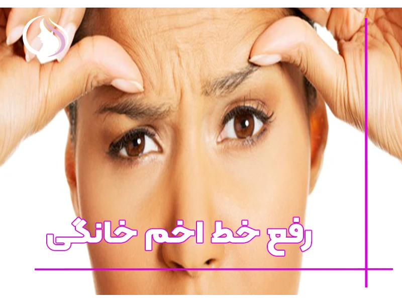 رفع خط اخم خانگی 