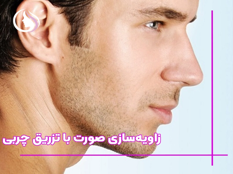 زاویه‌سازی صورت با تزریق چربی