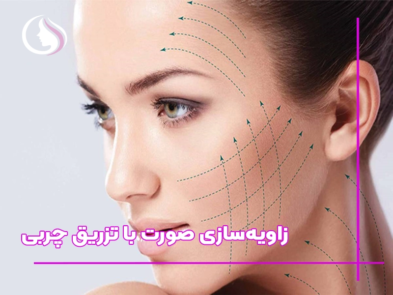 زاویه‌سازی صورت با چربی