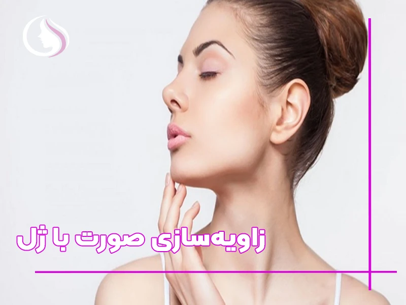 زاویه‌سازی صورت با ژل