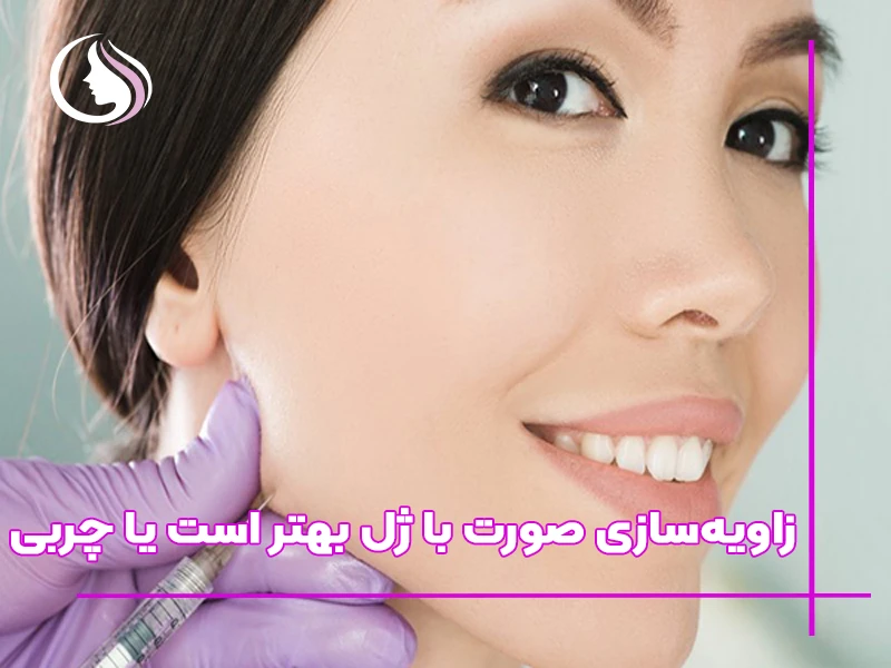 زاویه‌سازی صورت با ژل بهتر است یا چربی