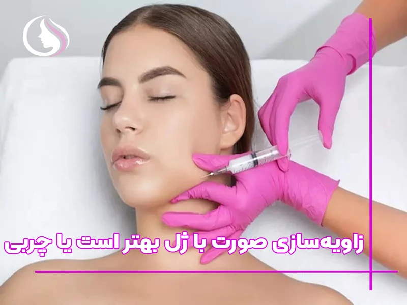 زاویه‌سازی صورت با ژل بهتر است یا چربی