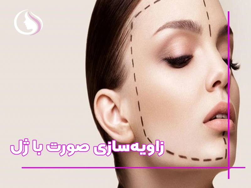 صفر تا صد زاویه‌ سازی صورت با ژل